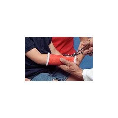 TAPE, CAST DELTACAST CNFRM 2"X4YDS WHT (10RL/CS)