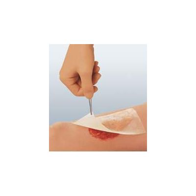 Cuticerin Oil Emulsion Impregnated Dressing, 3 x 3 Inch