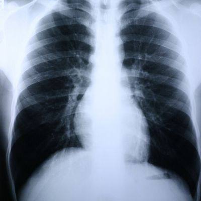 Clear Choice™ Performance X-Ray Film